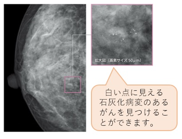 マンモグラフィ AIC八重洲クリニック